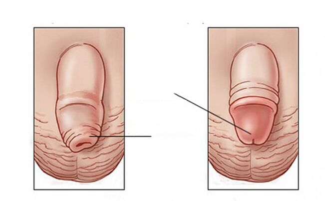 ¿Qué tarea cumple el lubricante