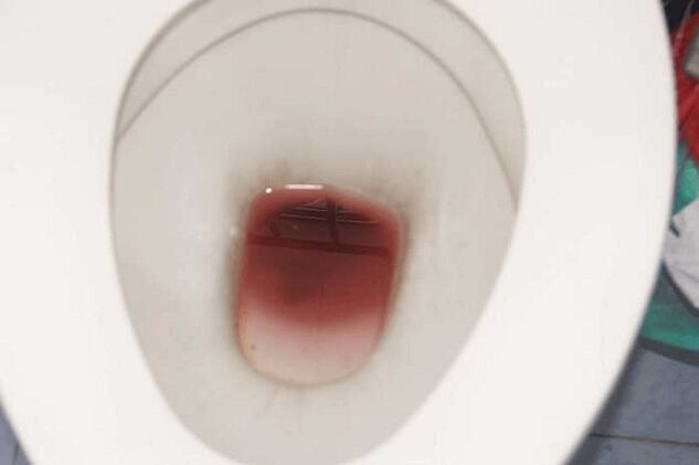 mancha en los hombres cuando están excitados